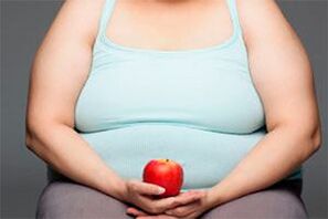 Varisli damarları tedavi etmek için fazla kilolardan kurtulmanız gerekir